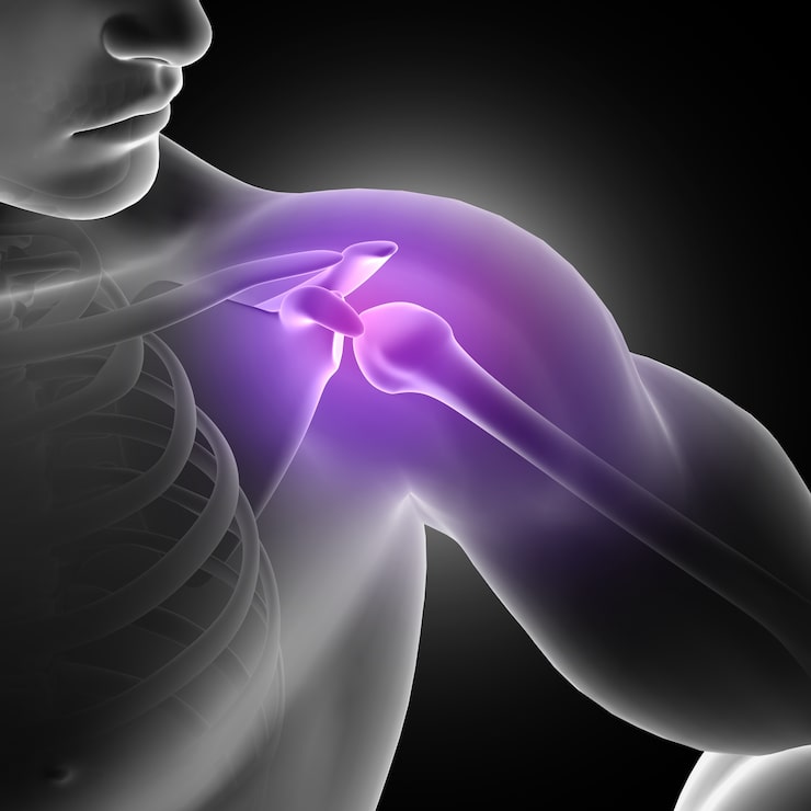 Arthroscopy for Frozen Shoulder