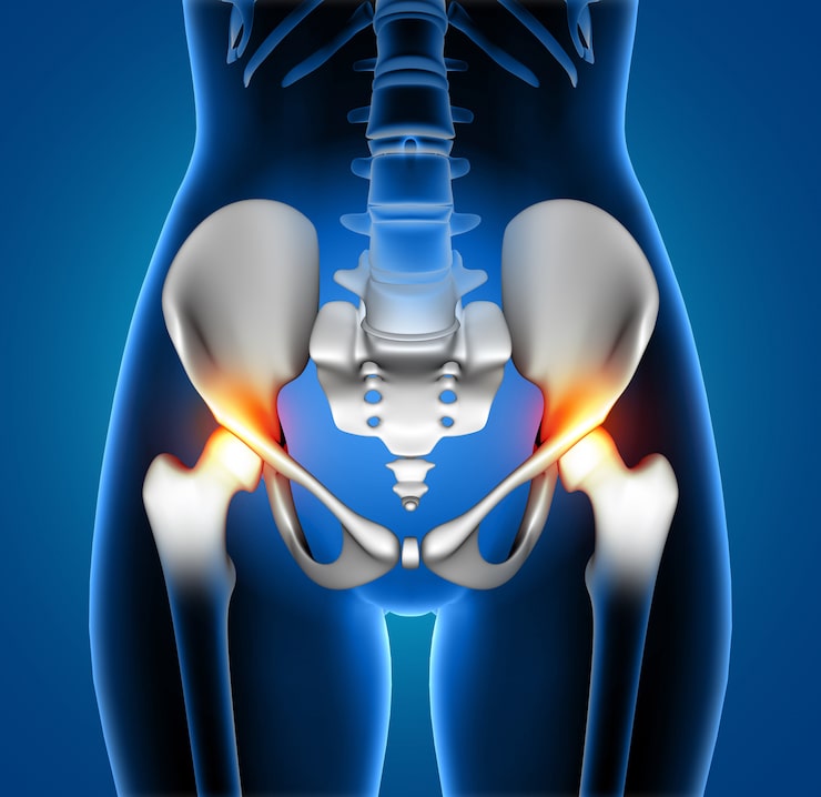 Hip Pain treatment in Indore