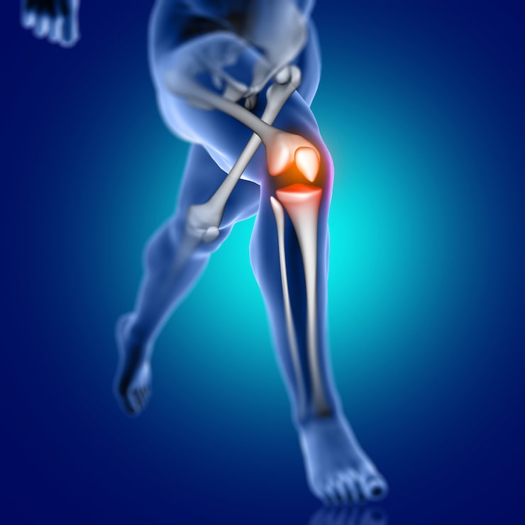 Knee Pain treatment in Indore