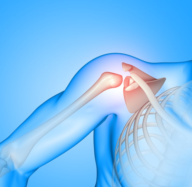 Shoulder Arthroscopy