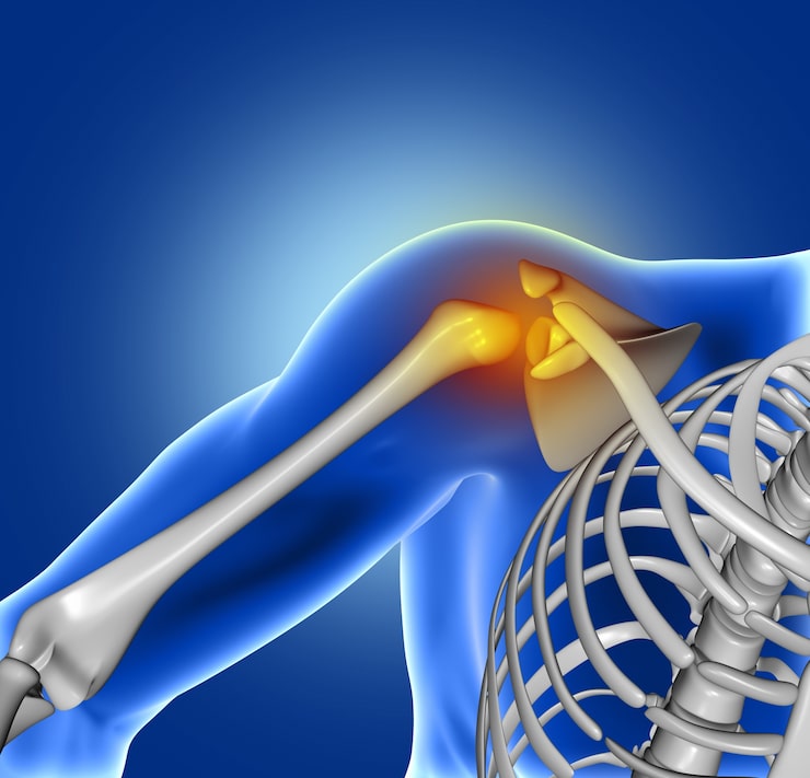 Shoulder Pain treatment in Indore